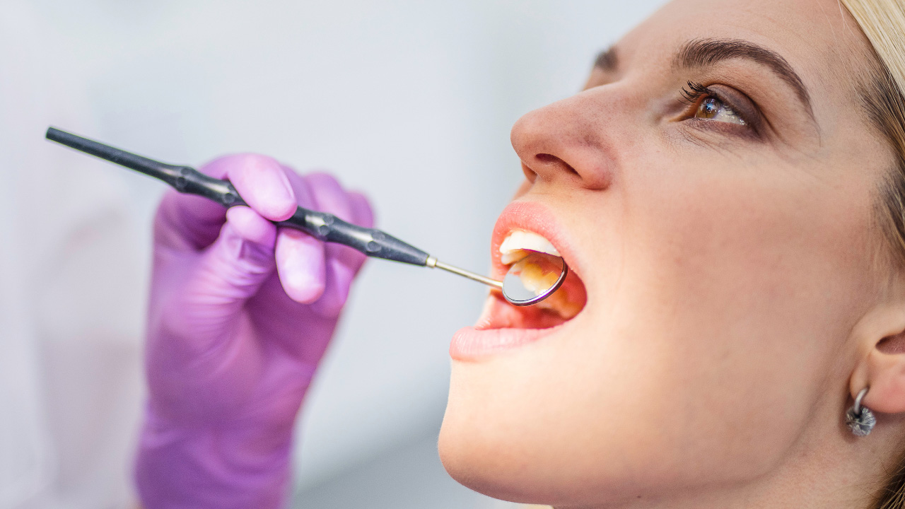 Tooth Extractions Open Wide La Jolla Dentistry